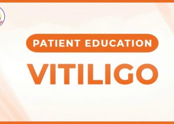 Vitiligo Safed Daag white spot Patient Education Tips Skin Specialist/Dermatologist